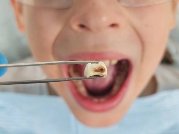 Best Emergency Dental Surgery in Bellmead, TX